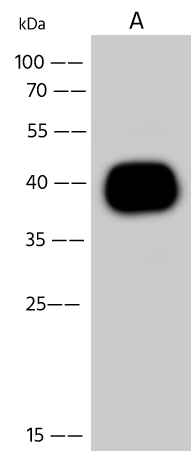 CHIKV-E2-pAb(A)-HD18OC2803-WB.png